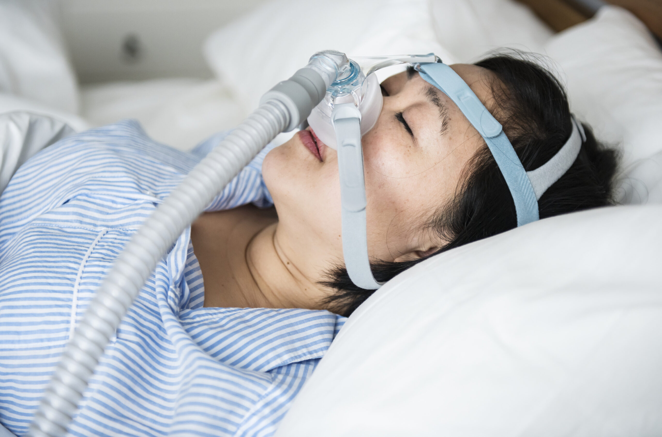 Apnée du sommeil et syndrome d’Ehlers-Danlos : un lien souvent méconnu